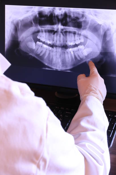 Best Emergency Dentist for Lost Fillings or Crowns in Salem, IN