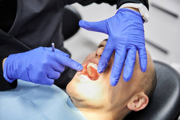 Best Emergency Dentist for Knocked-Out Tooth in Salem, IN